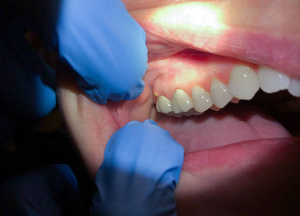 Best After-Hours Emergency Dentist in Keeler Farm, NM