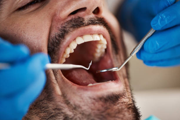 Best Emergency Treatment for Toothache in Keeler Farm, NM